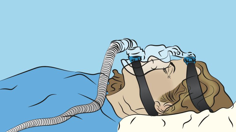 CPAP_ventile