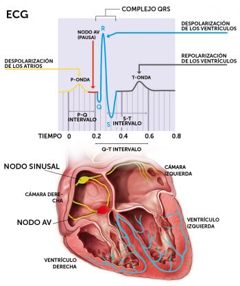 Electrocardiograma